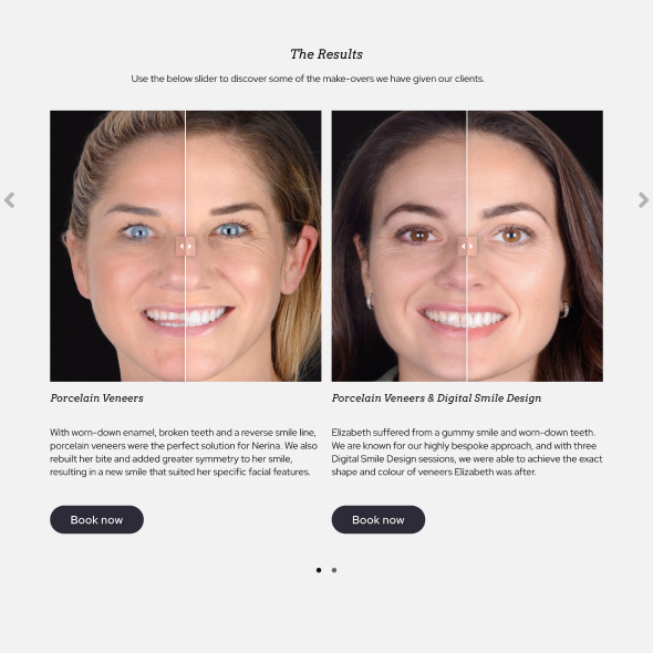 dental -lounge-result